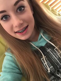 Young teen girls braces facial