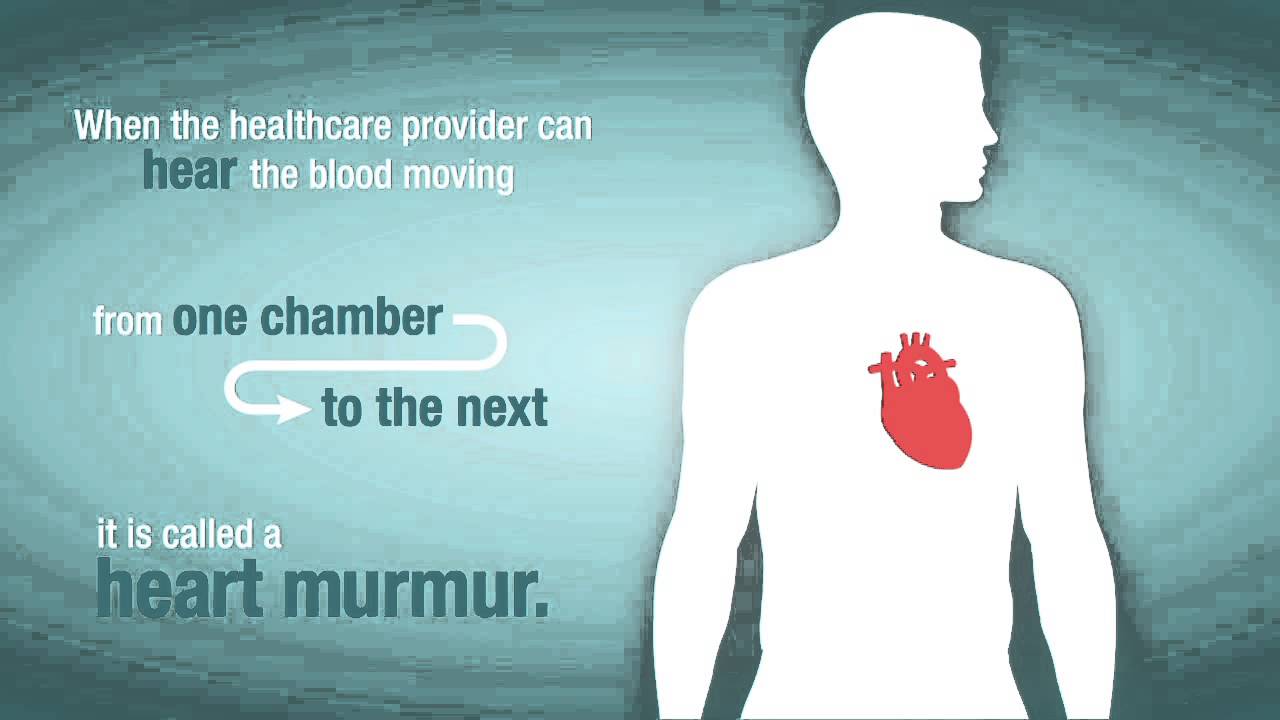 Heart murmur in adult