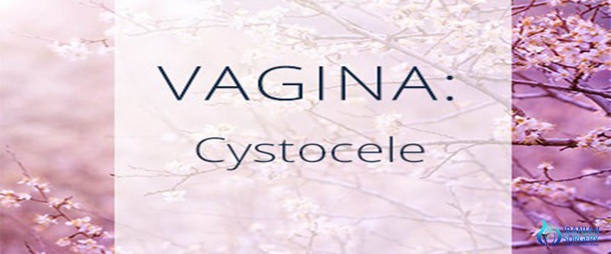 Cost of vaginal surgery