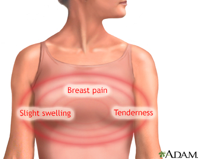 Breast soreness after menopause