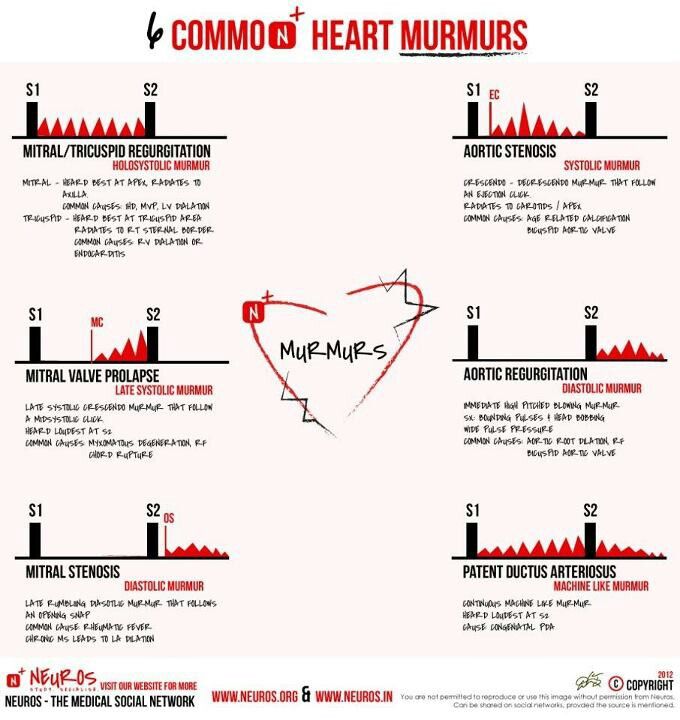 Heart murmur in adult