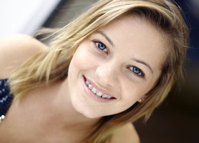 Young teen girls braces facial