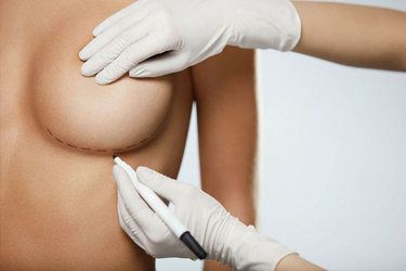 How to soften breast capsular contraction