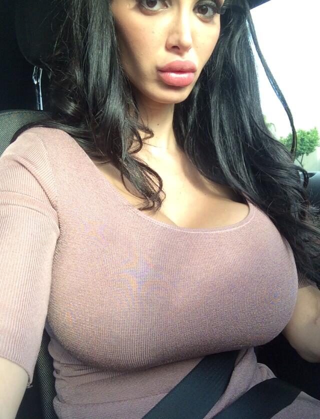 Amy anderssen fake boobs